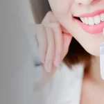Teeth Whitening