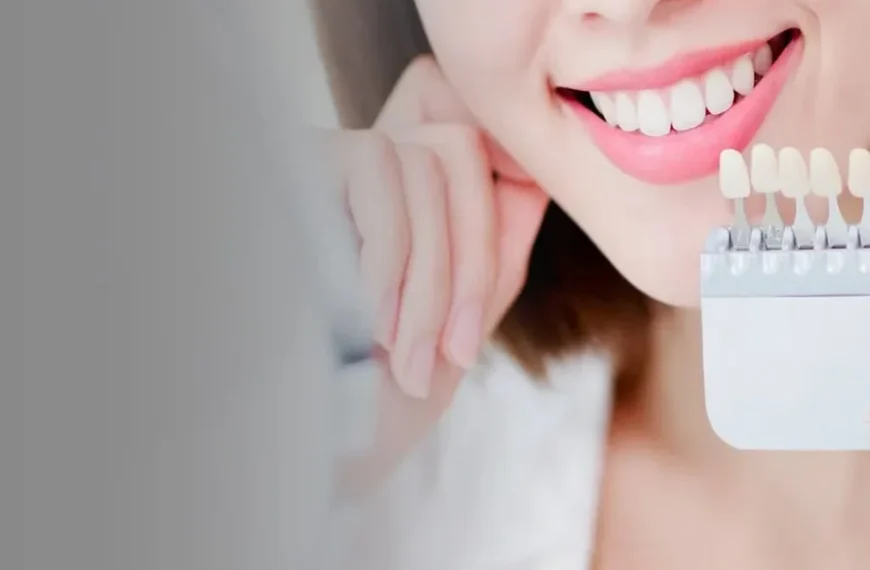 Teeth Whitening