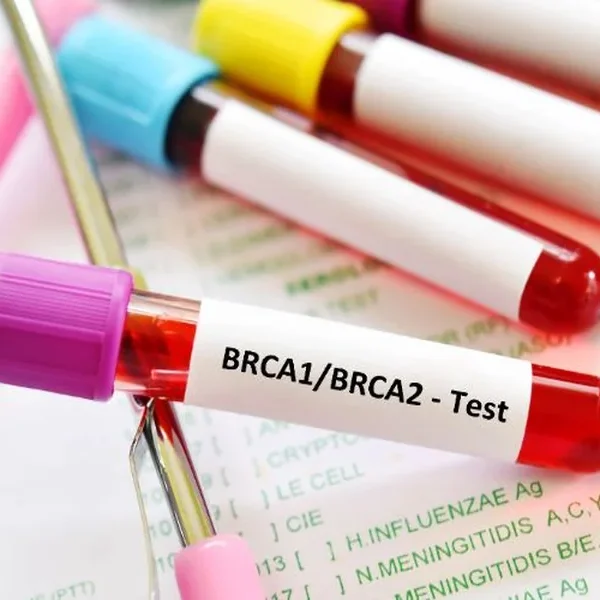BRCA Testing