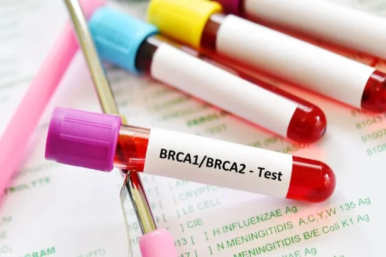 BRCA Testing