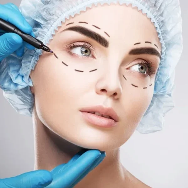 Ptosis Correction in Singapore 