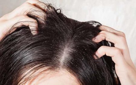 Best Hair Care Products For Teens From Anti-Dandruff To Hair Fall Solutions