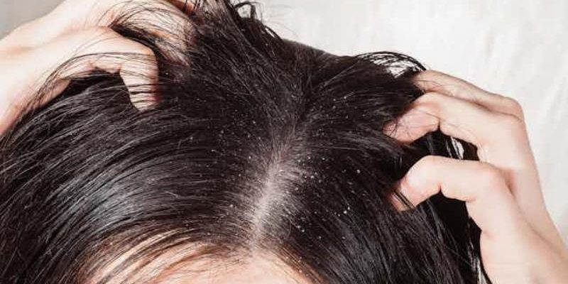 Best Hair Care Products For Teens From Anti-Dandruff To Hair Fall Solutions