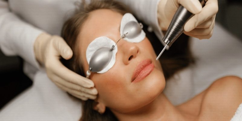 Laser Treatment