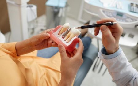 How Periodontal Maintenance Protects Your Implant Investment