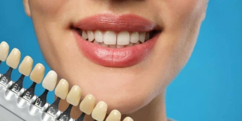 How Cosmetic Dentistry Restores Confidence Beyond Aesthetics