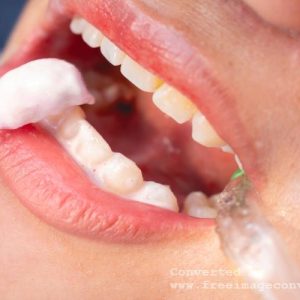 Fluoride Applications